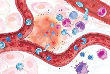 Effekt vu Boswellia op entzündte Gebidder vum Kierper